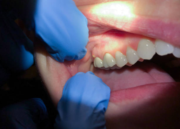 Best Emergency Denture Repair in Mertzon, TX