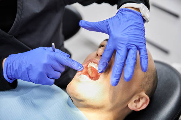 Best Knocked-Out Tooth (Avulsed Tooth) Treatment in Mertzon, TX