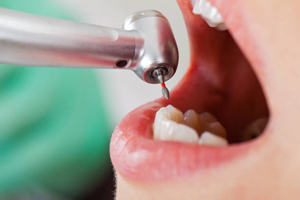 Best Emergency Pediatric Dental Care in Mertzon, TX